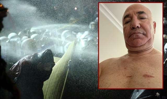 Βουλευτής CHP Τανάλ: «Ξυλοκοπήθηκα από την αστυνομία κατά τις διαδηλώσεις υπέρ Ιμάμογλου»